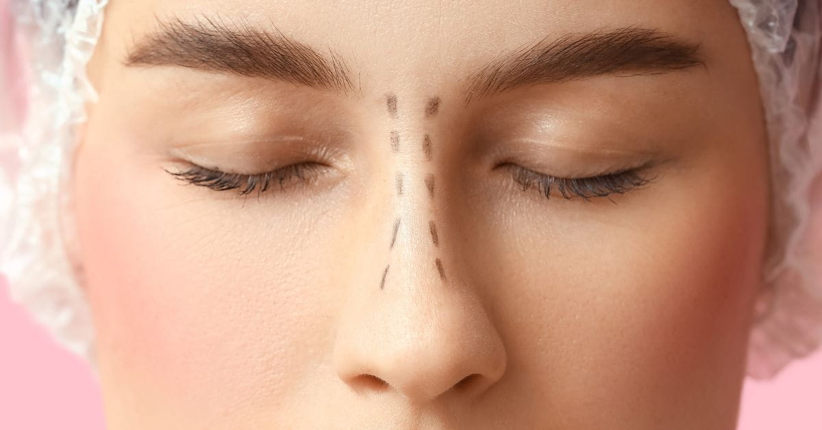 nose surgery